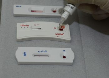 Experiência brasileira no enfrentamento às hepatites virais traz aprendizados para lidar com novas emergências de saúde