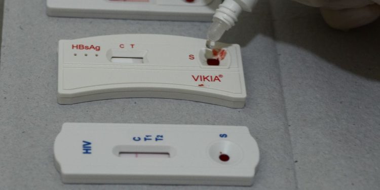 Experiência brasileira no enfrentamento às hepatites virais traz aprendizados para lidar com novas emergências de saúde